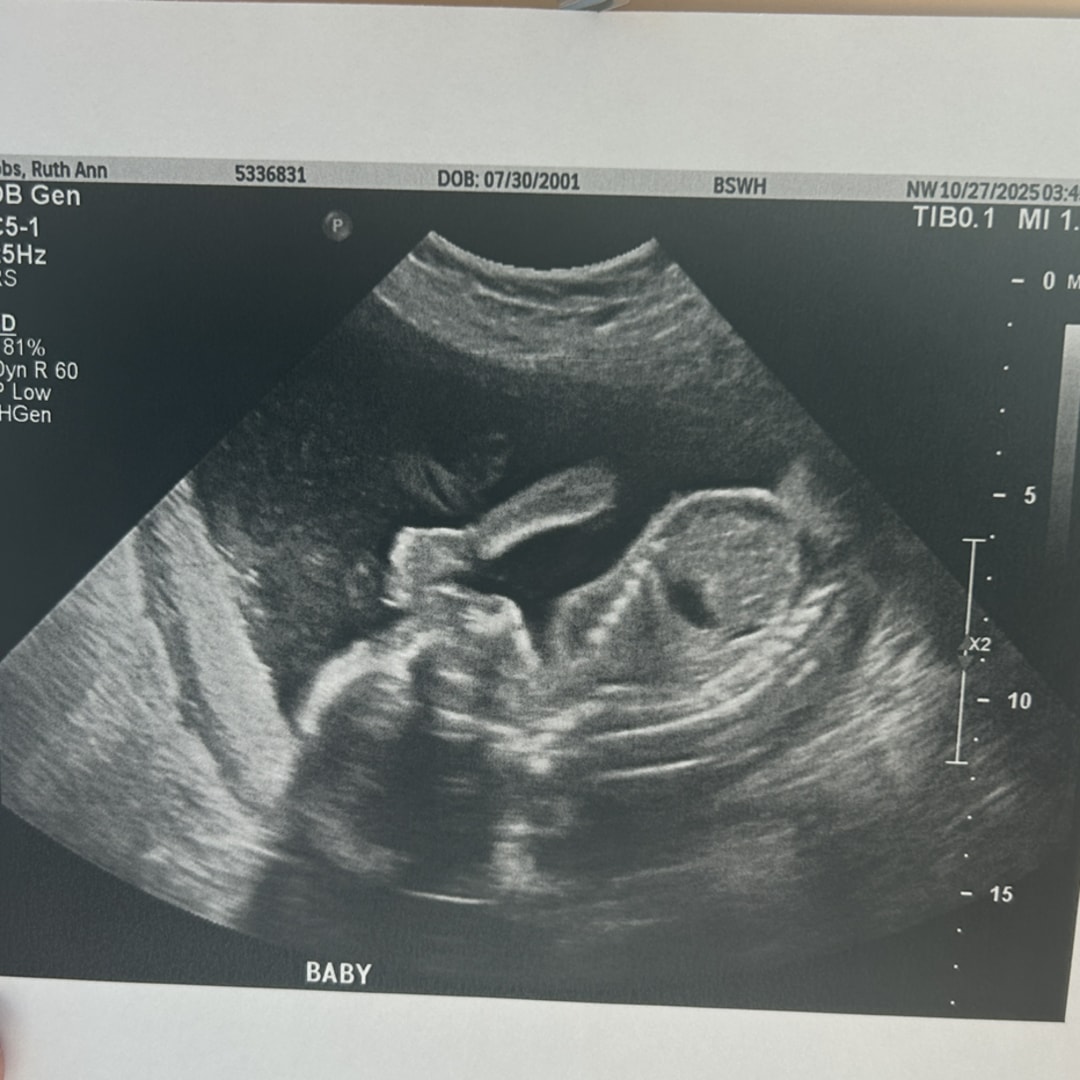 Photo shared by Ruth for their Babylist baby registry.