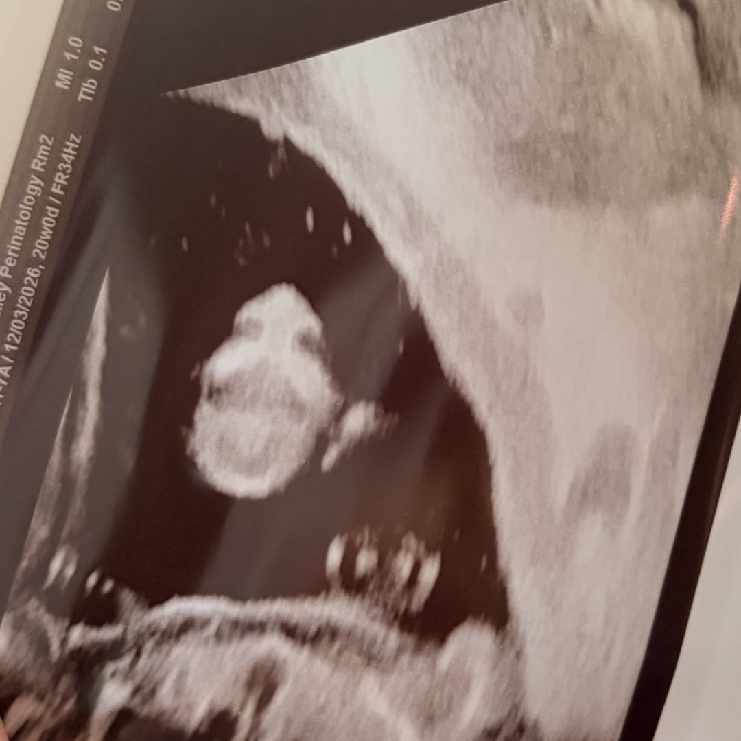 Photo shared by Isabelle for their Babylist baby registry.