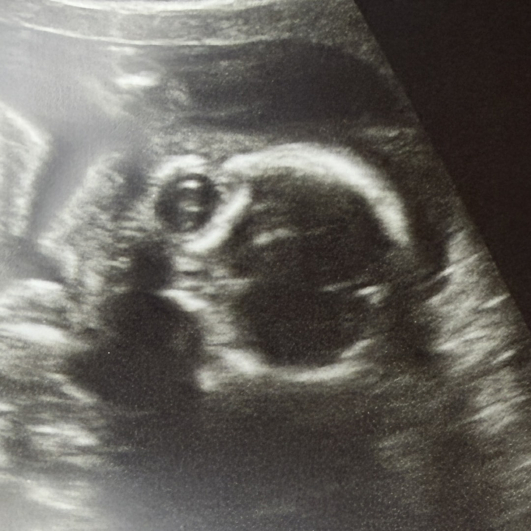 Photo shared by Abby for their Babylist baby registry.
