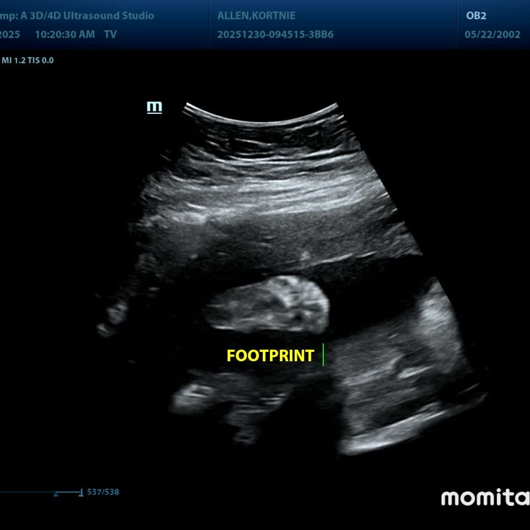 Photo shared by Kortnie for their Babylist baby registry.