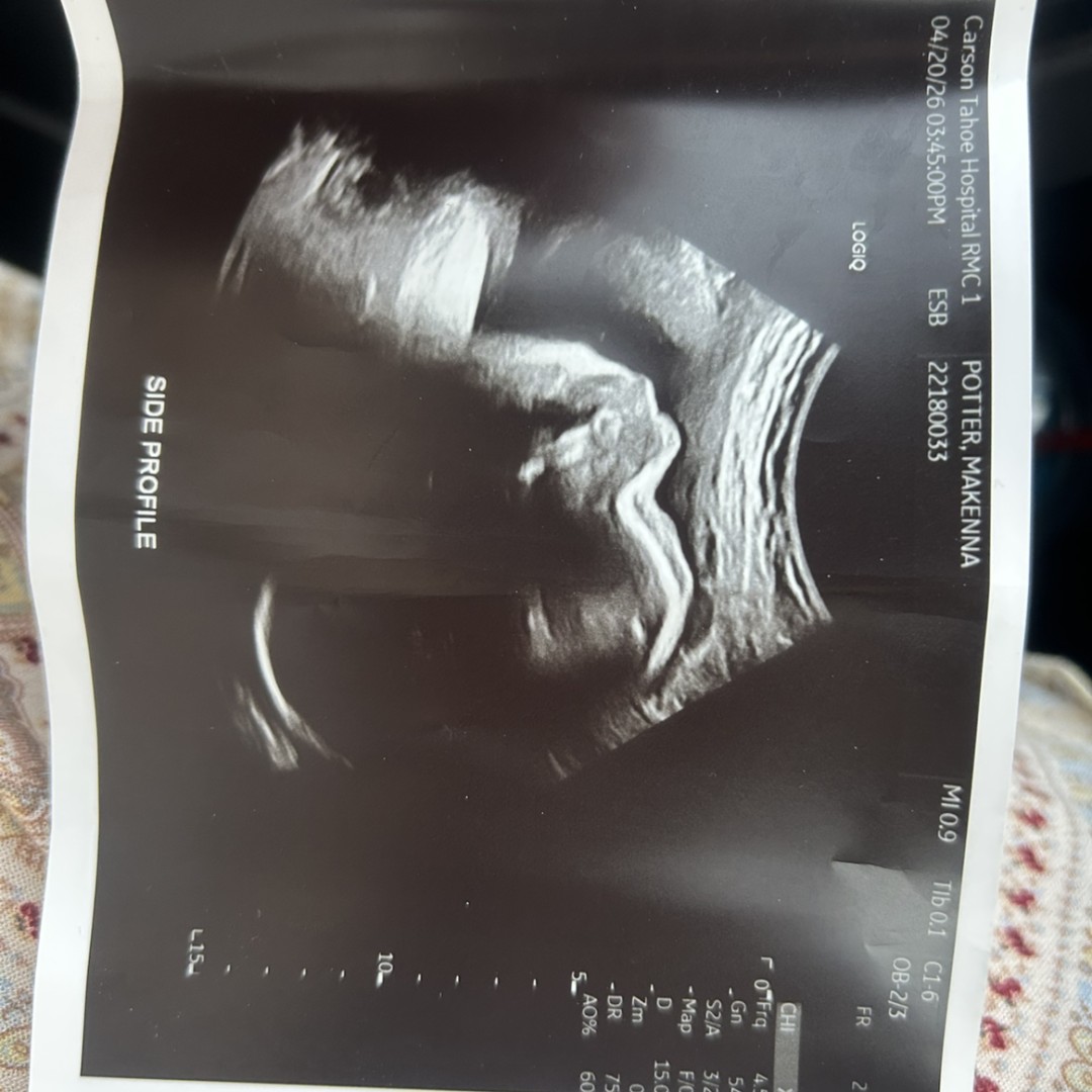 Photo shared by Makenna for their Babylist baby registry.