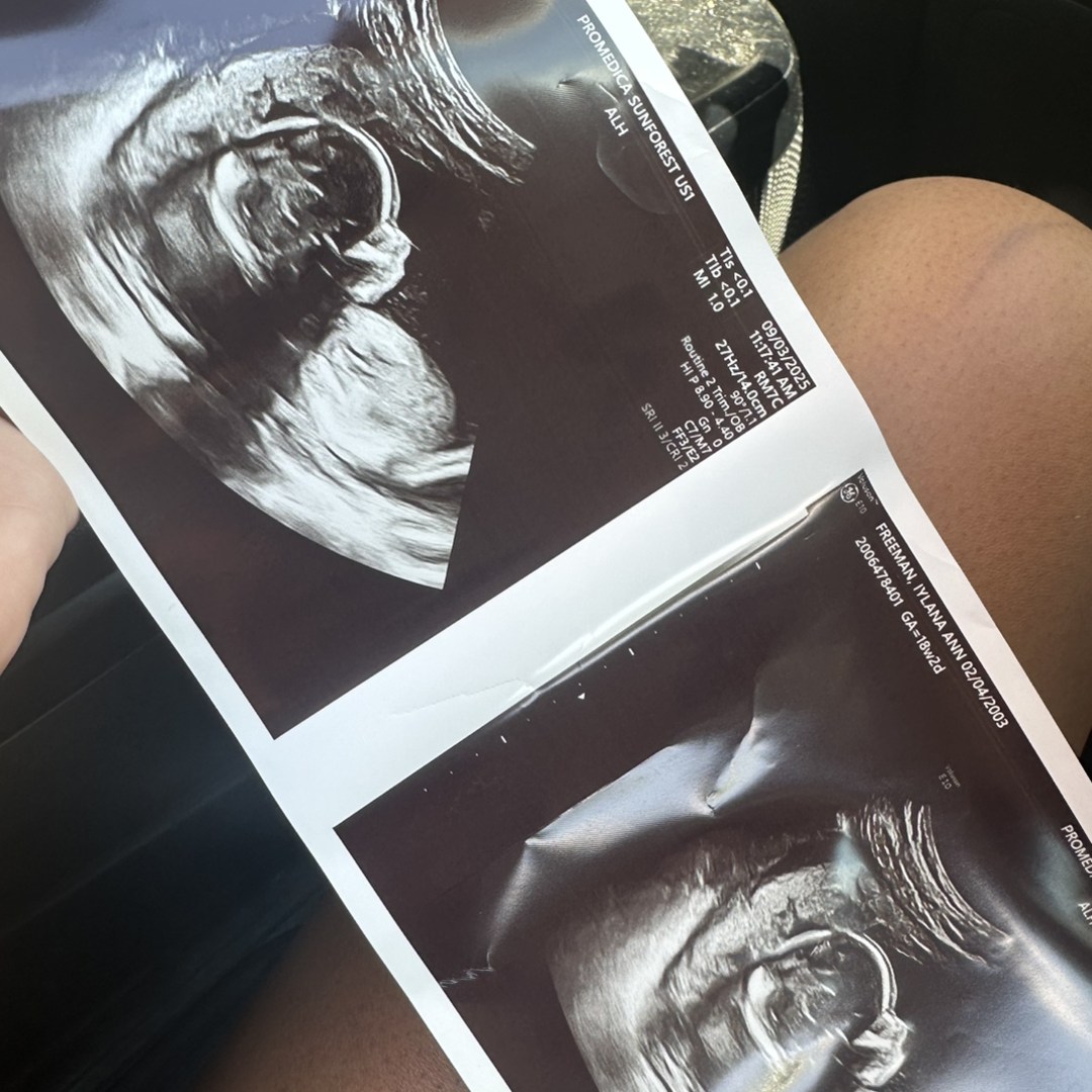 Photo shared by Iylana for their Babylist baby registry.