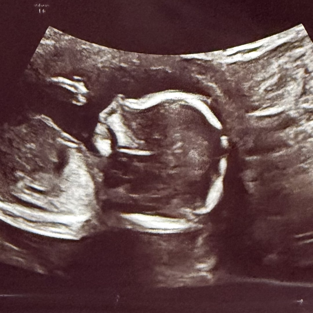 Photo shared by Casely for their Babylist baby registry.