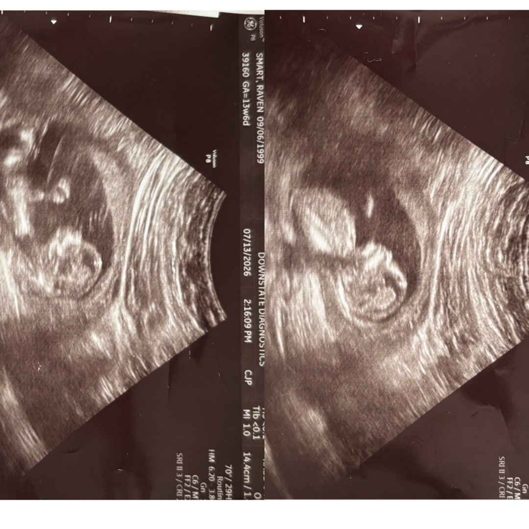 Photo shared by Raven for their Babylist baby registry.