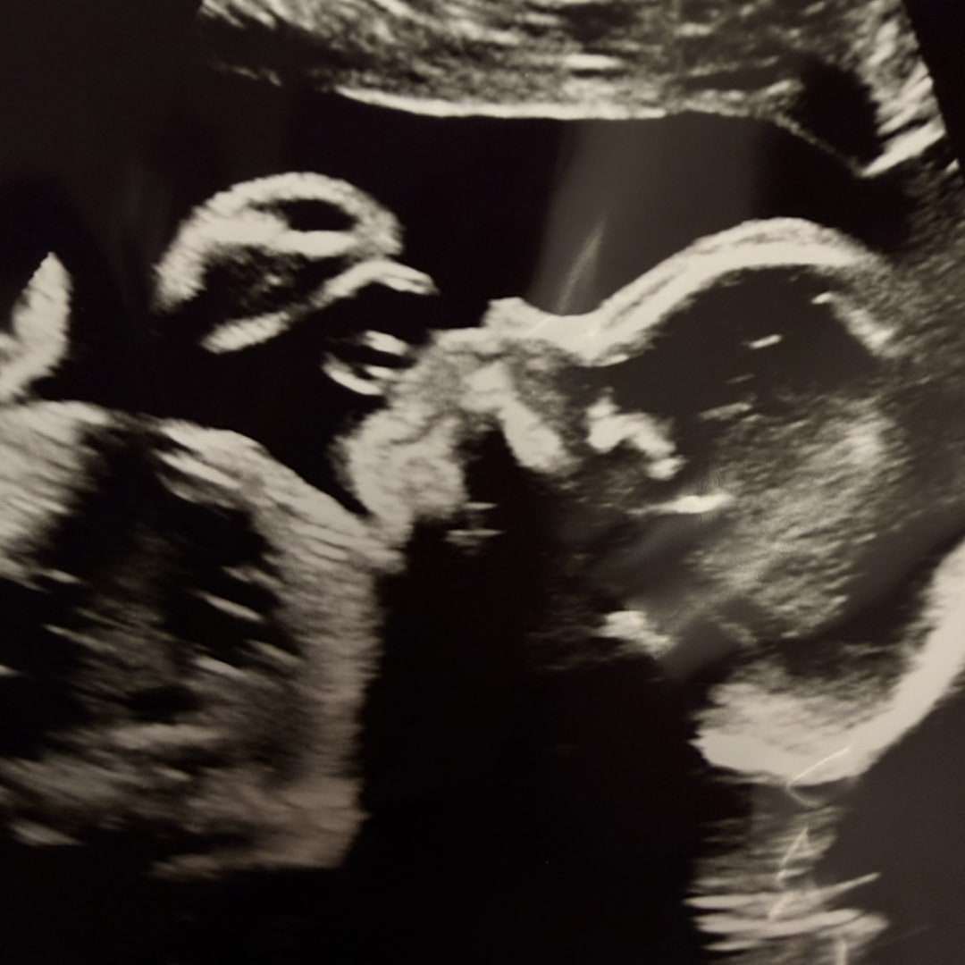 Photo shared by Taylor for their Babylist baby registry.