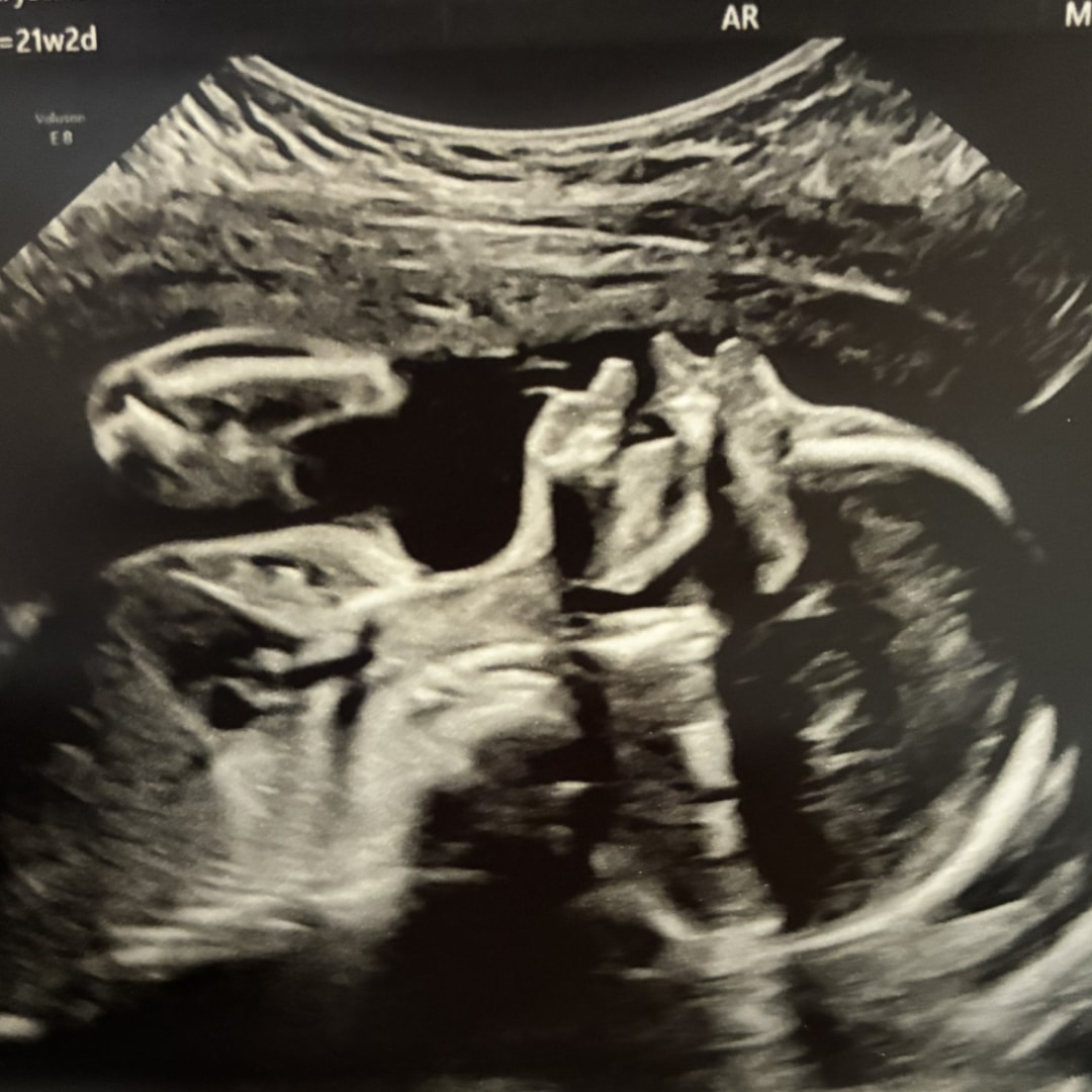 Photo shared by Kat for their Babylist baby registry.