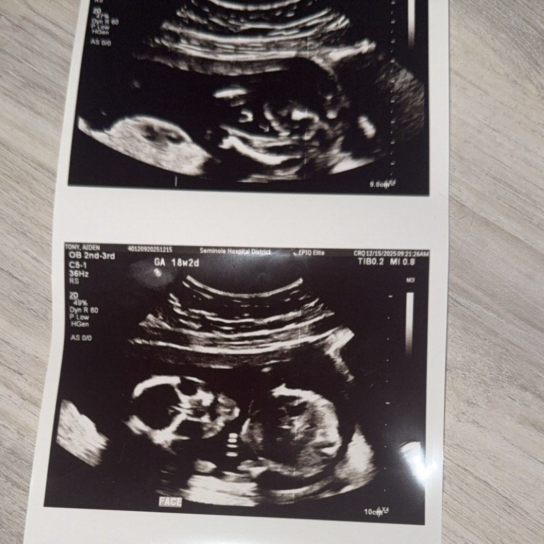 Photo shared by Aidyn for their Babylist baby registry.