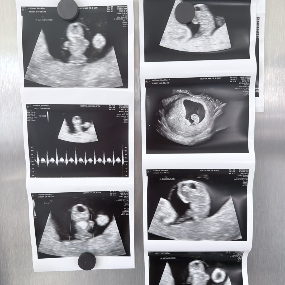 Photo shared by Brooklyn for their Babylist baby registry.