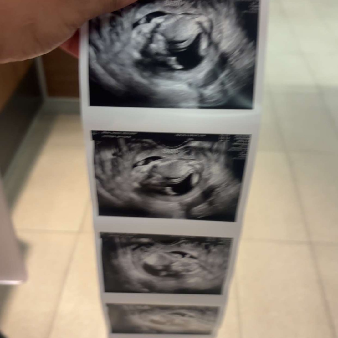 Photo shared by Jenasia for their Babylist baby registry.