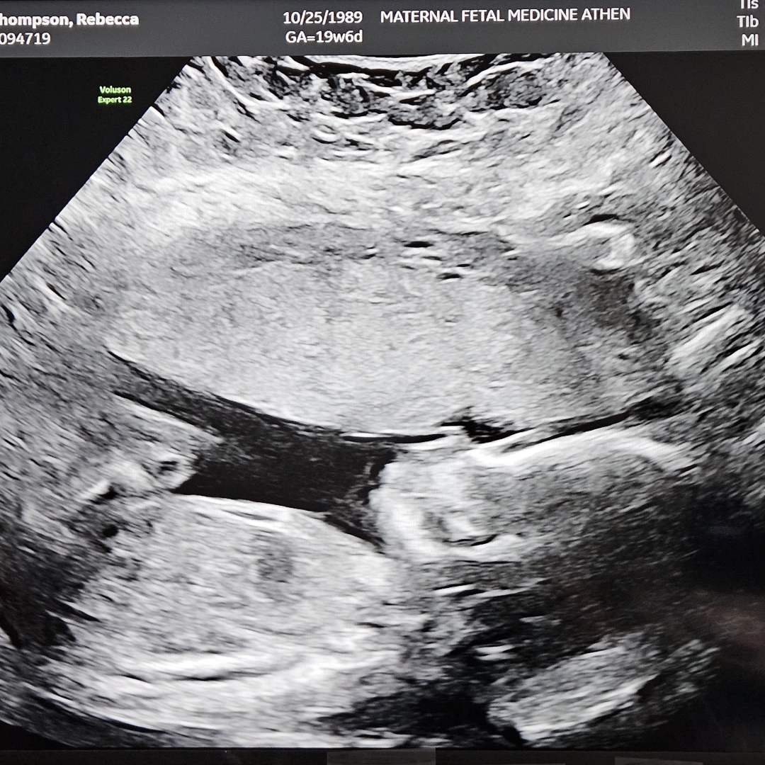 Photo shared by Rebecca for their Babylist baby registry.