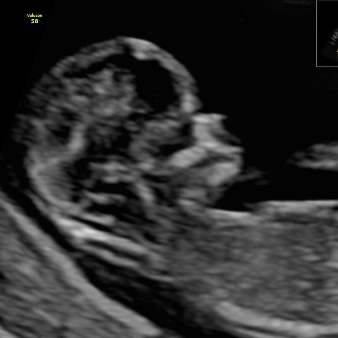 Photo shared by Ashley for their Babylist baby registry.