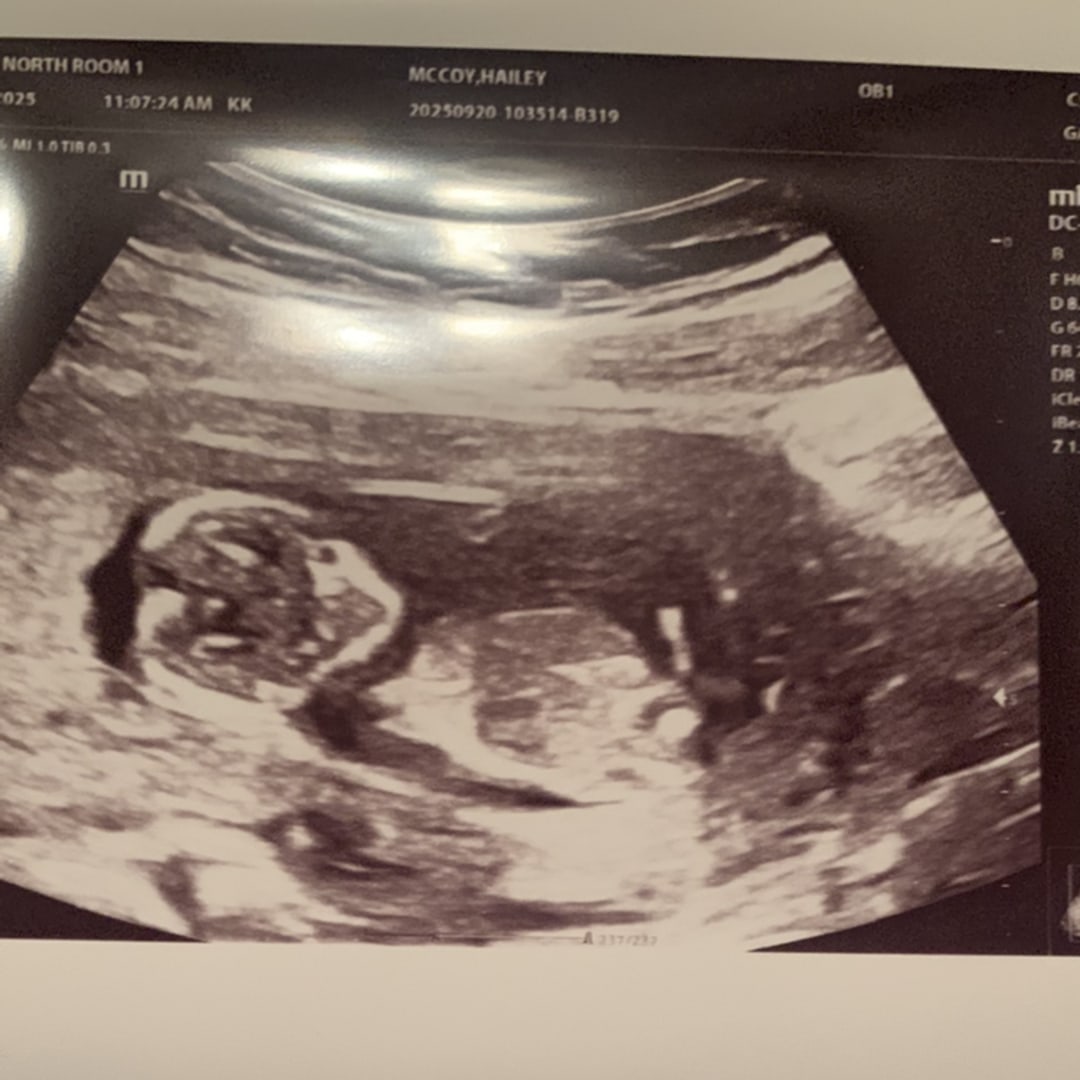 Photo shared by Hailey for their Babylist baby registry.