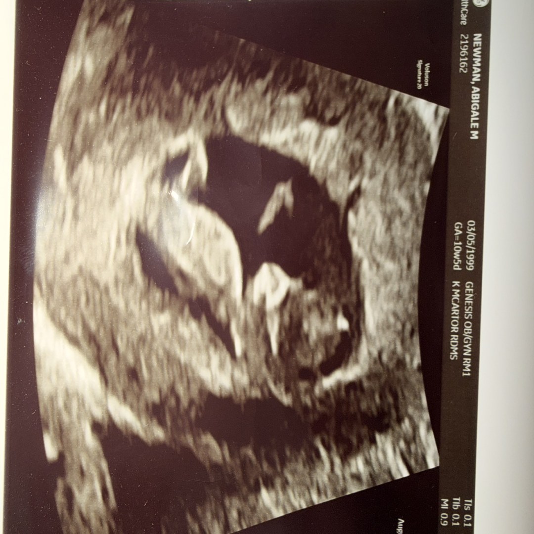 Photo shared by Abigale for their Babylist baby registry.