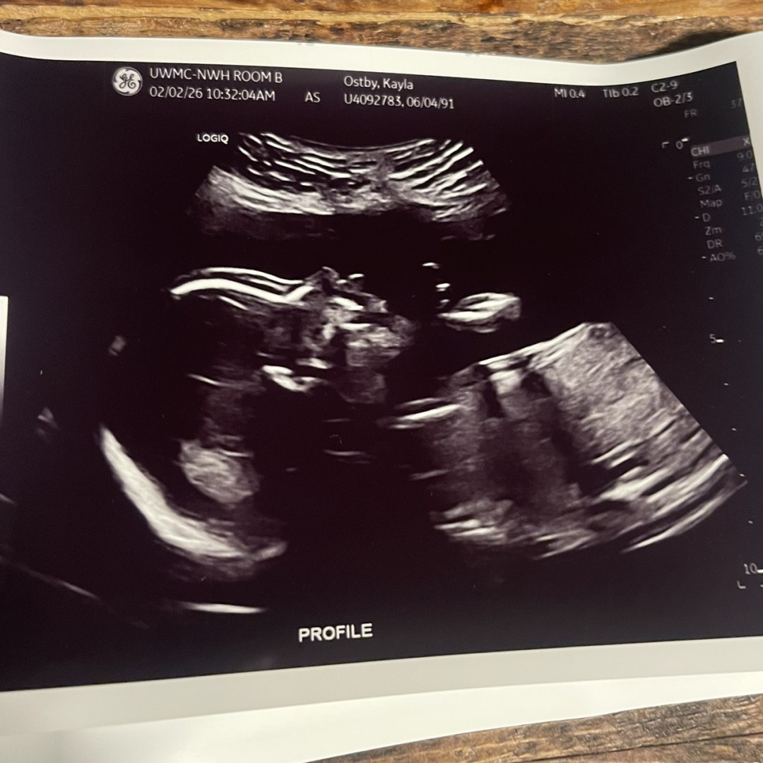 Photo shared by Kayla for their Babylist baby registry.
