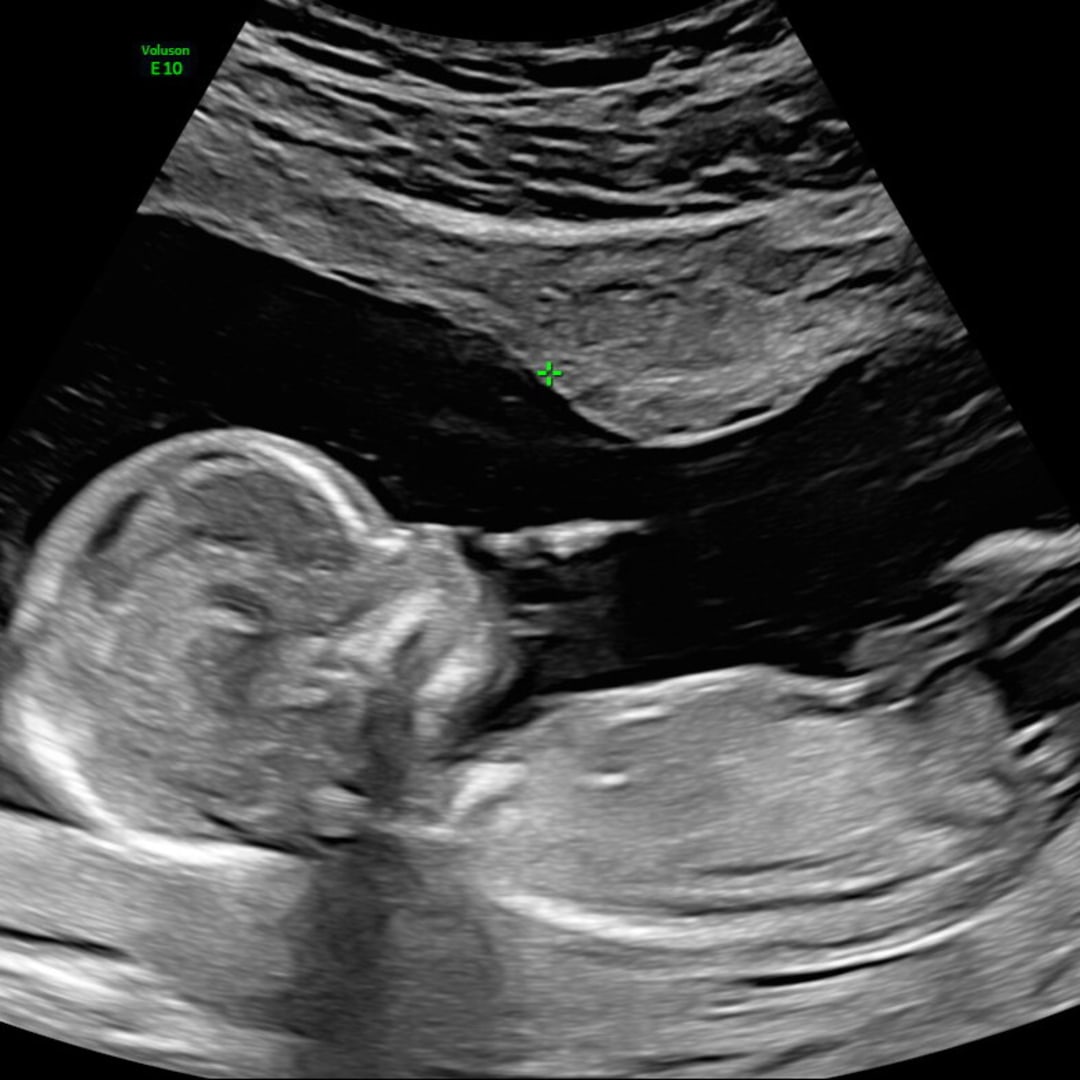 Photo shared by Alexis for their Babylist baby registry.