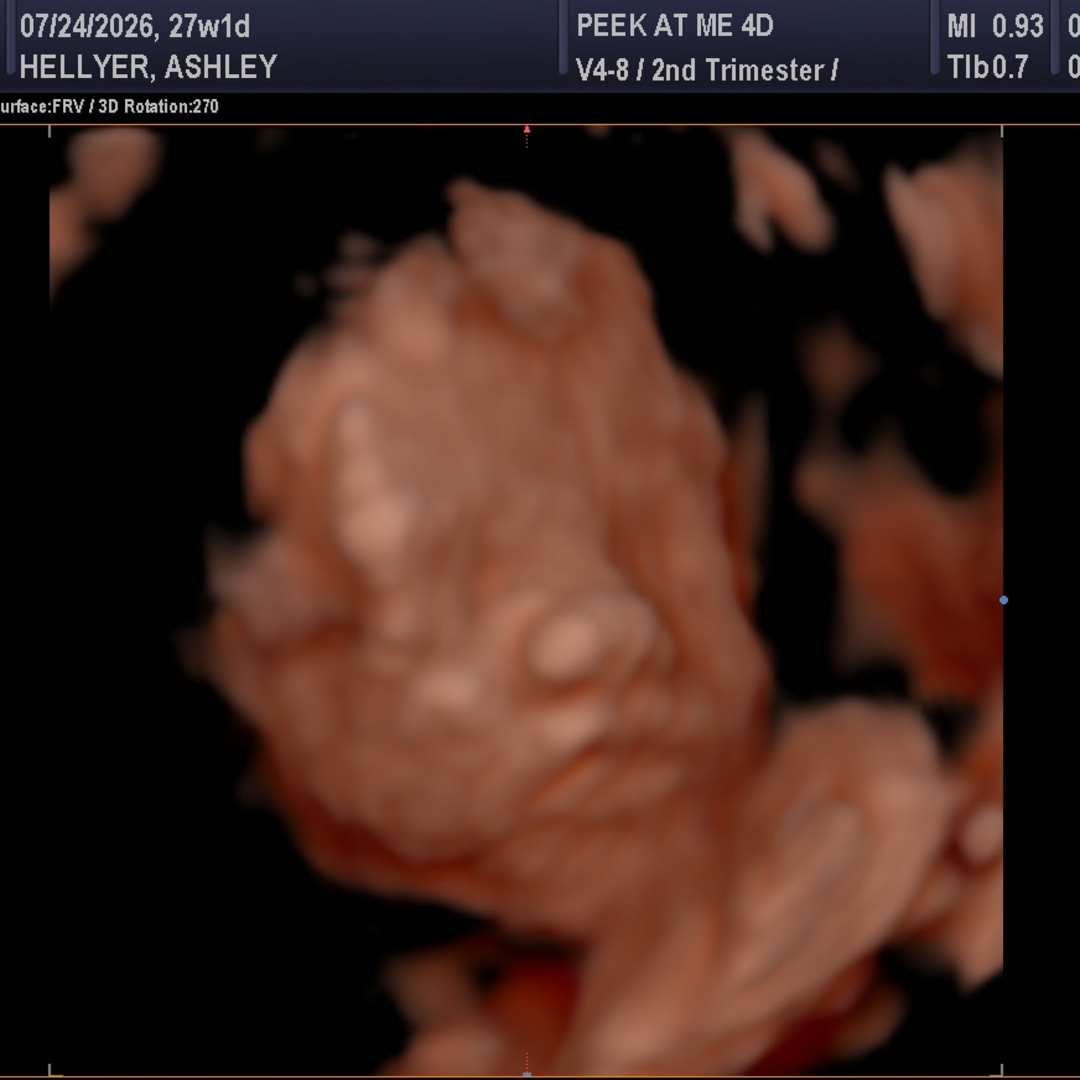 Photo shared by Ashley for their Babylist baby registry.