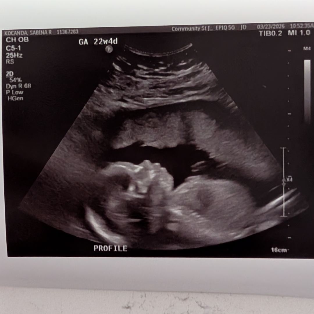 Photo shared by Sabina for their Babylist baby registry.