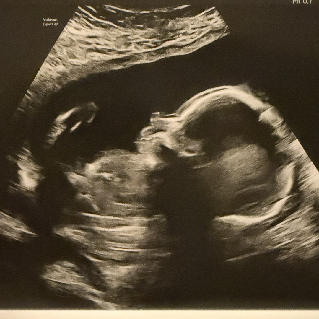 Photo shared by Michelle & Alek for their Babylist baby registry.