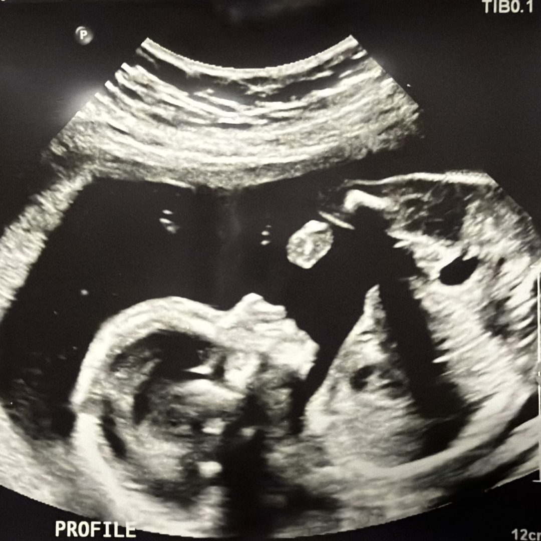 Photo shared by Alexa for their Babylist baby registry.