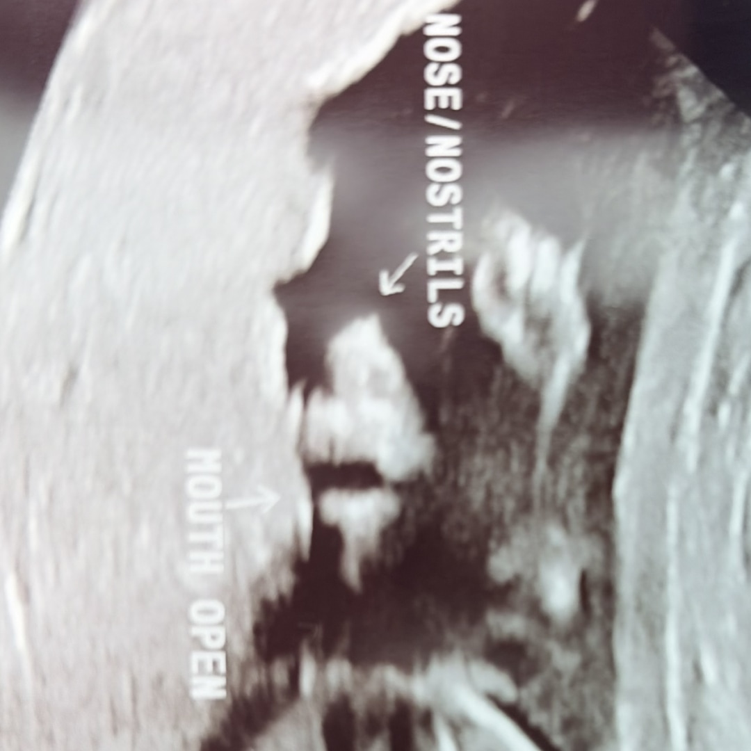 Photo shared by Caitlin for their Babylist baby registry.