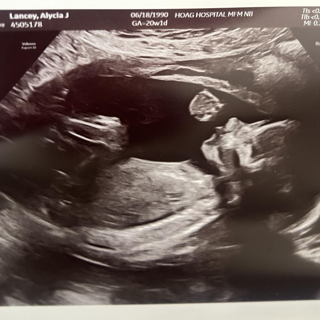 Photo shared by Alycia for their Babylist baby registry.