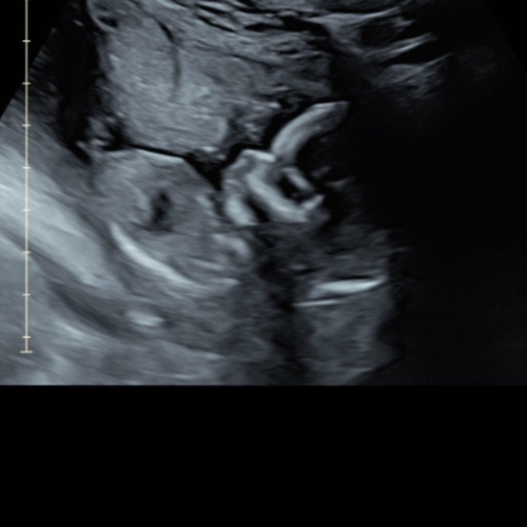 Photo shared by Ann Marie for their Babylist baby registry.