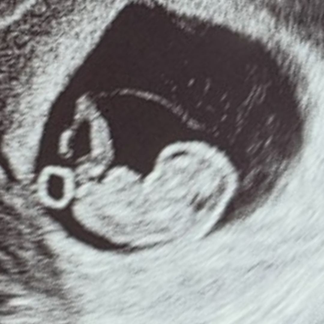 Photo shared by Darius for their Babylist baby registry.