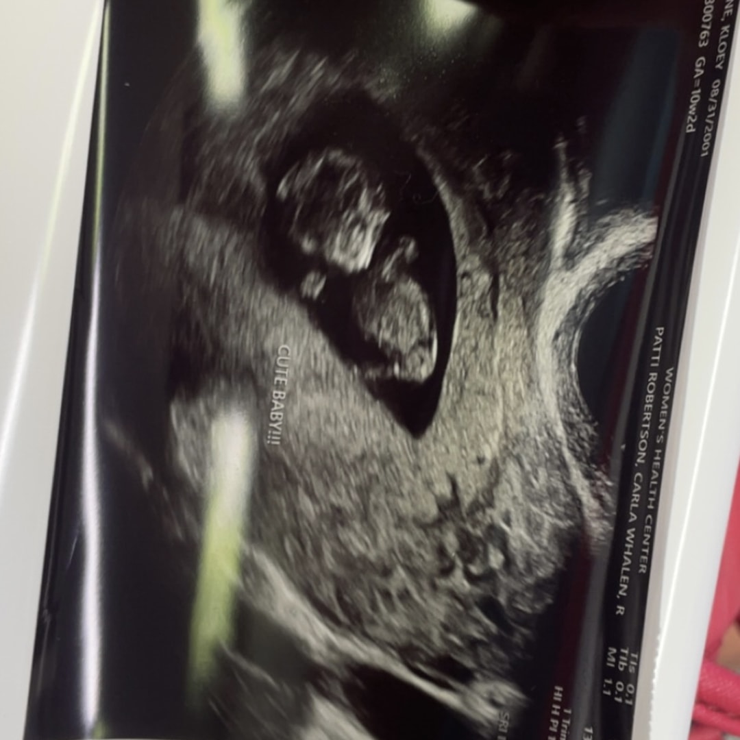 Photo shared by Kloey for their Babylist baby registry.