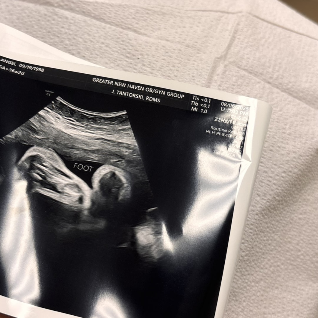 Photo shared by Angel Nicole for their Babylist baby registry.