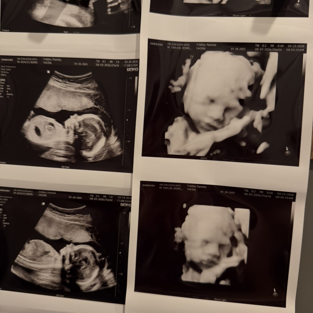 Photo shared by Pamela for their Babylist baby registry.
