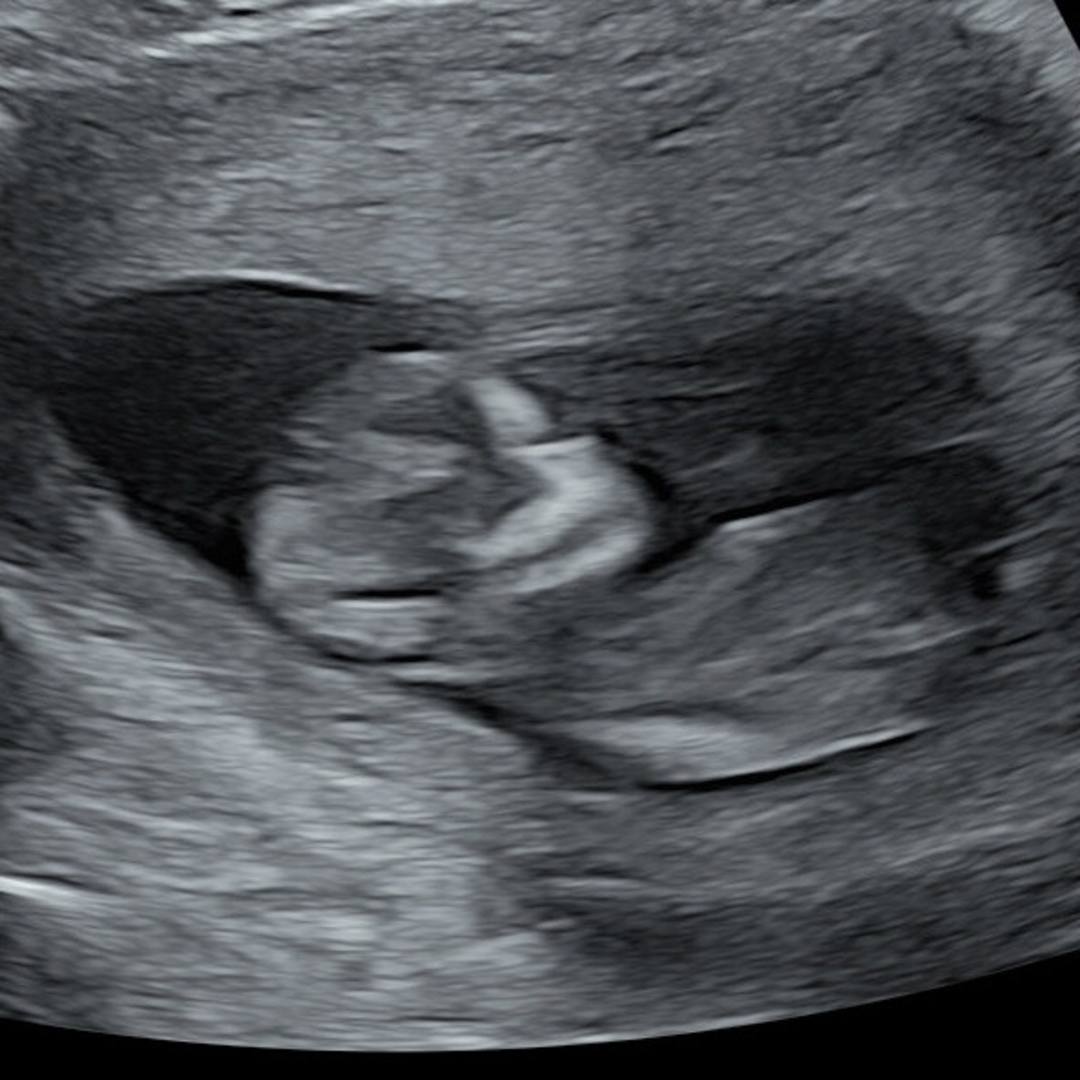 Photo shared by Chantalle for their Babylist baby registry.