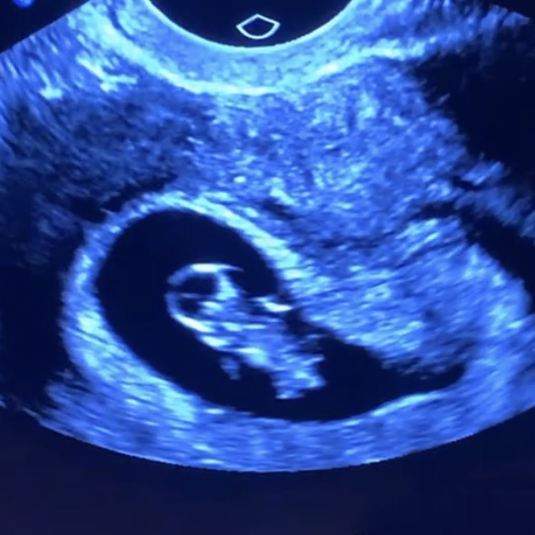 Photo shared by Allison for their Babylist baby registry.