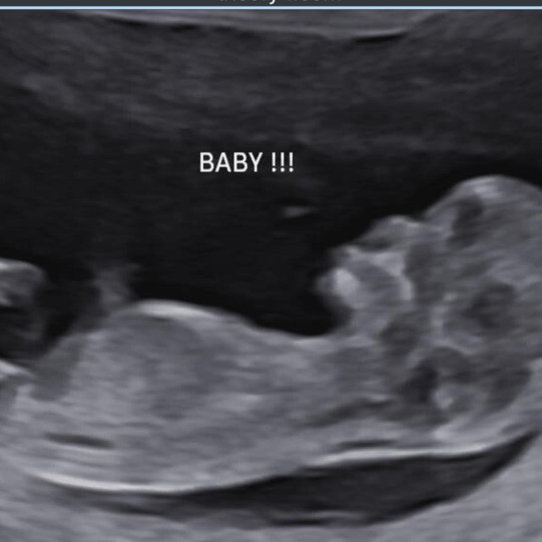 Photo shared by Megan for their Babylist baby registry.