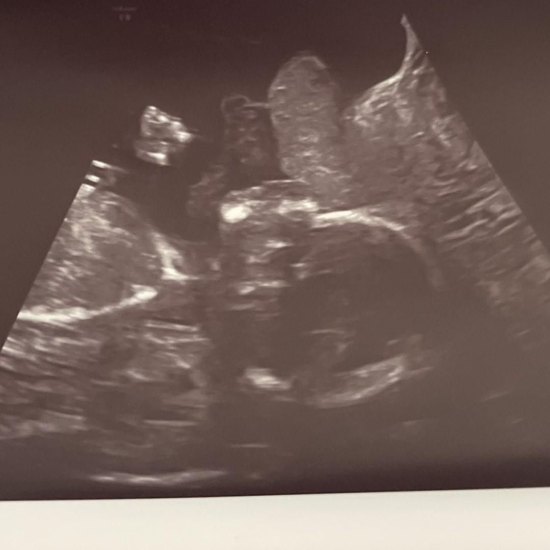 Photo shared by Jordan for their Babylist baby registry.