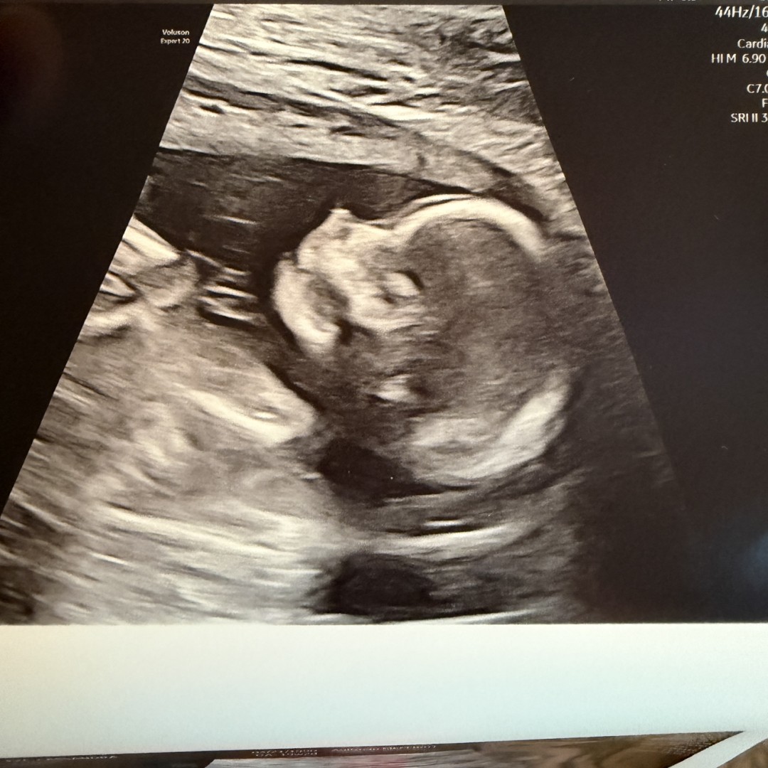 Photo shared by Cassey for their Babylist baby registry.