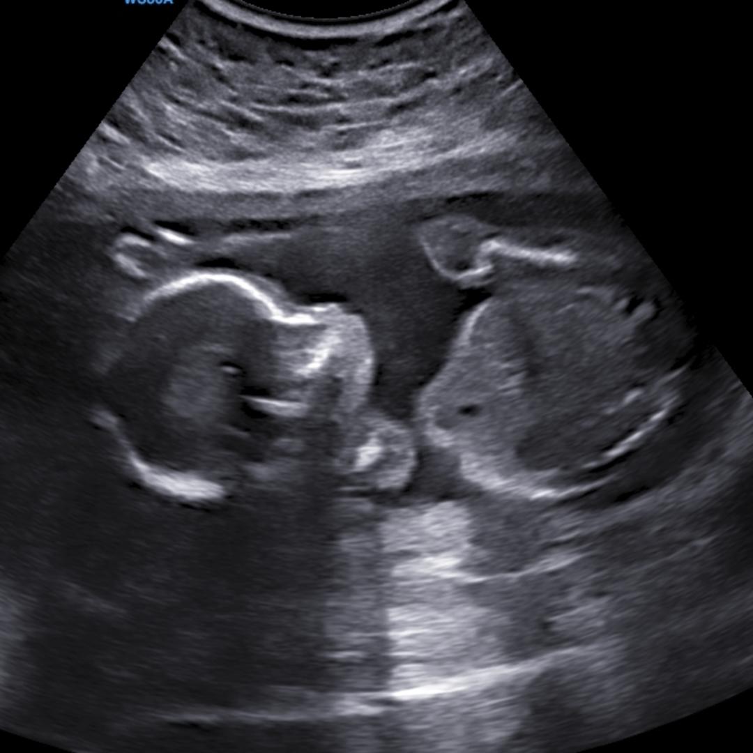 Photo shared by Kyra for their Babylist baby registry.