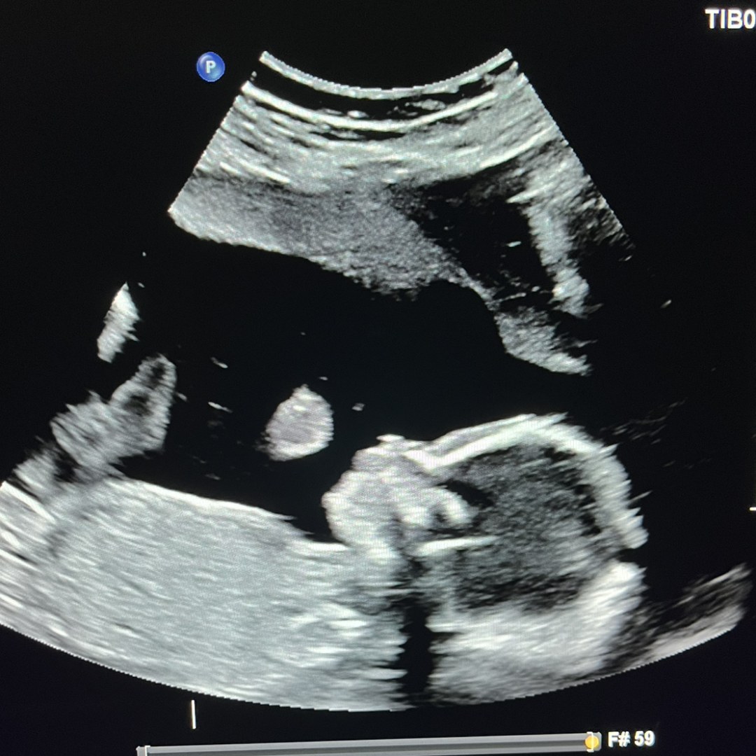 Photo shared by Kylee for their Babylist baby registry.