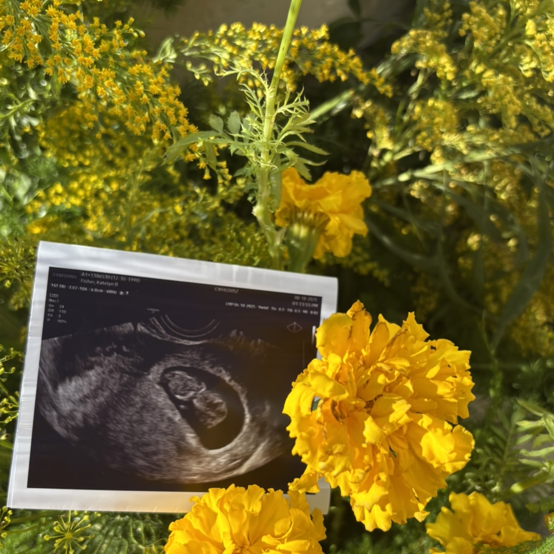 Photo shared by Katelyn for their Babylist baby registry.