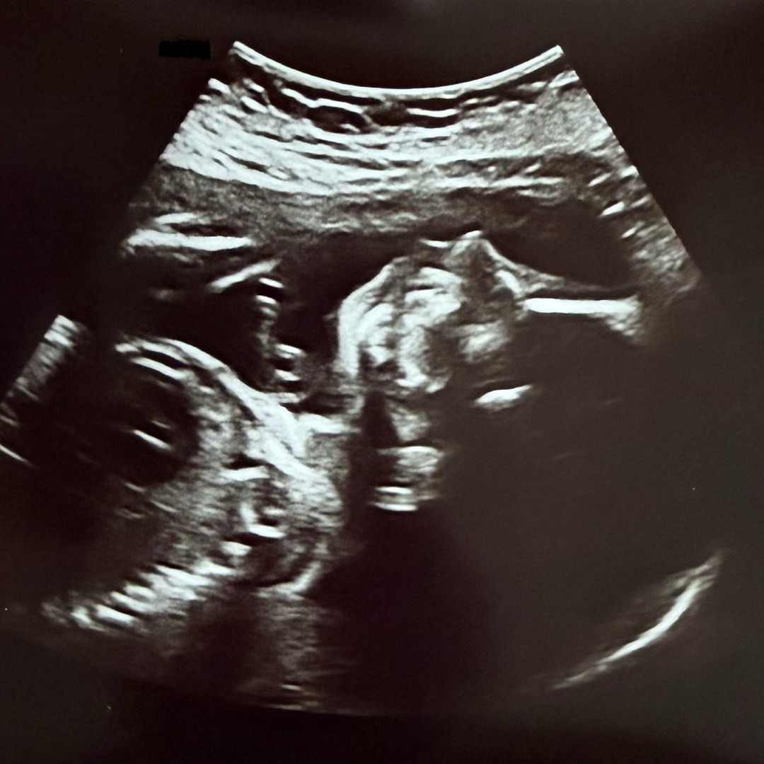 Photo shared by Caitlin for their Babylist baby registry.