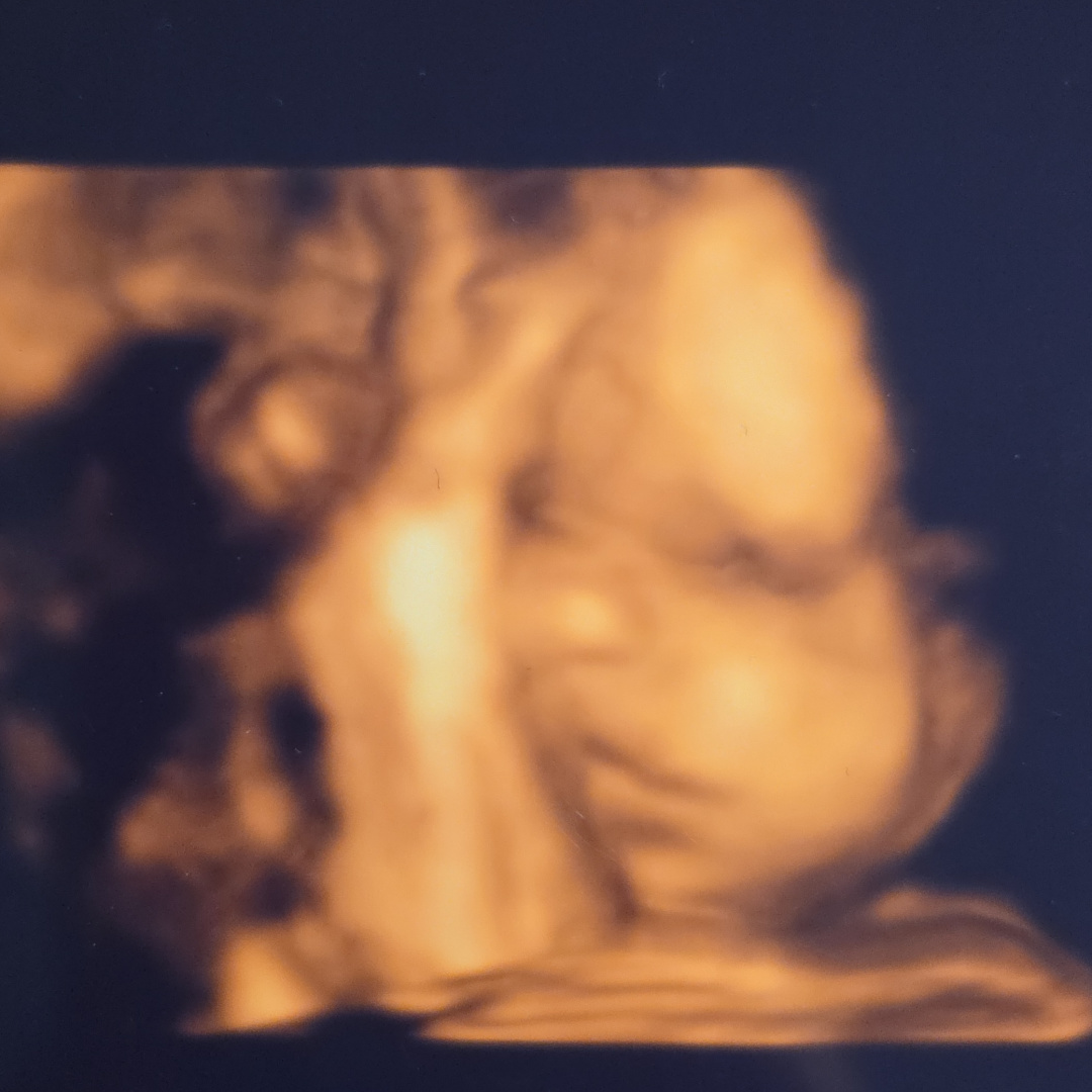 Photo shared by Christopher for their Babylist baby registry.