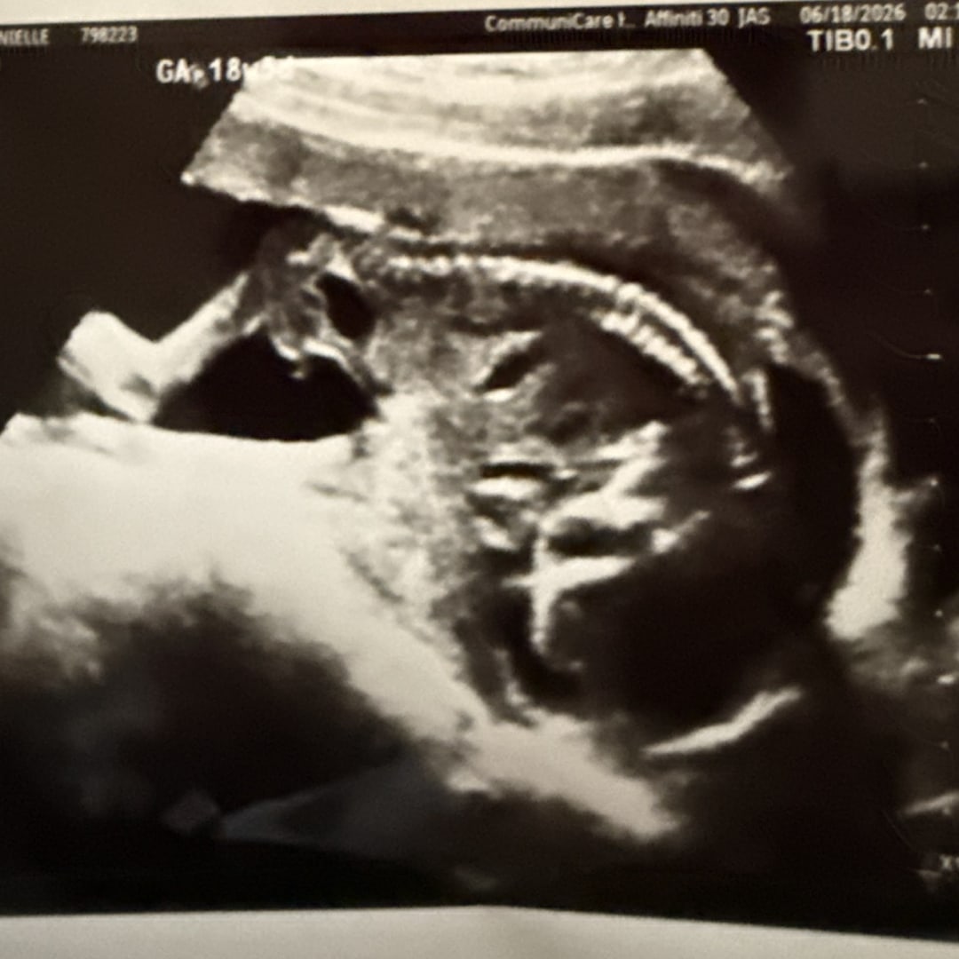 Photo shared by Danielle for their Babylist baby registry.