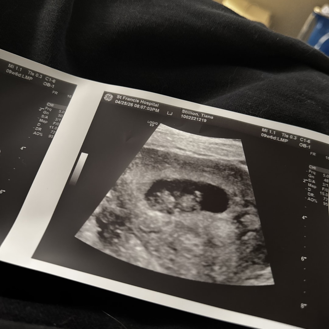 Photo shared by Zhanna for their Babylist baby registry.