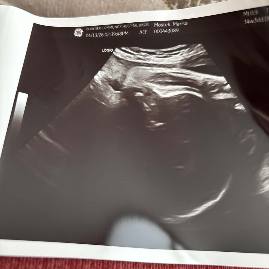 Photo shared by Marisa for their Babylist baby registry.