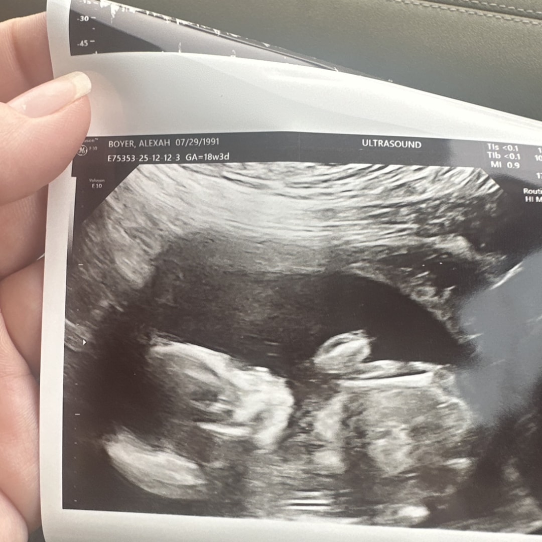 Photo shared by Alexah for their Babylist baby registry.