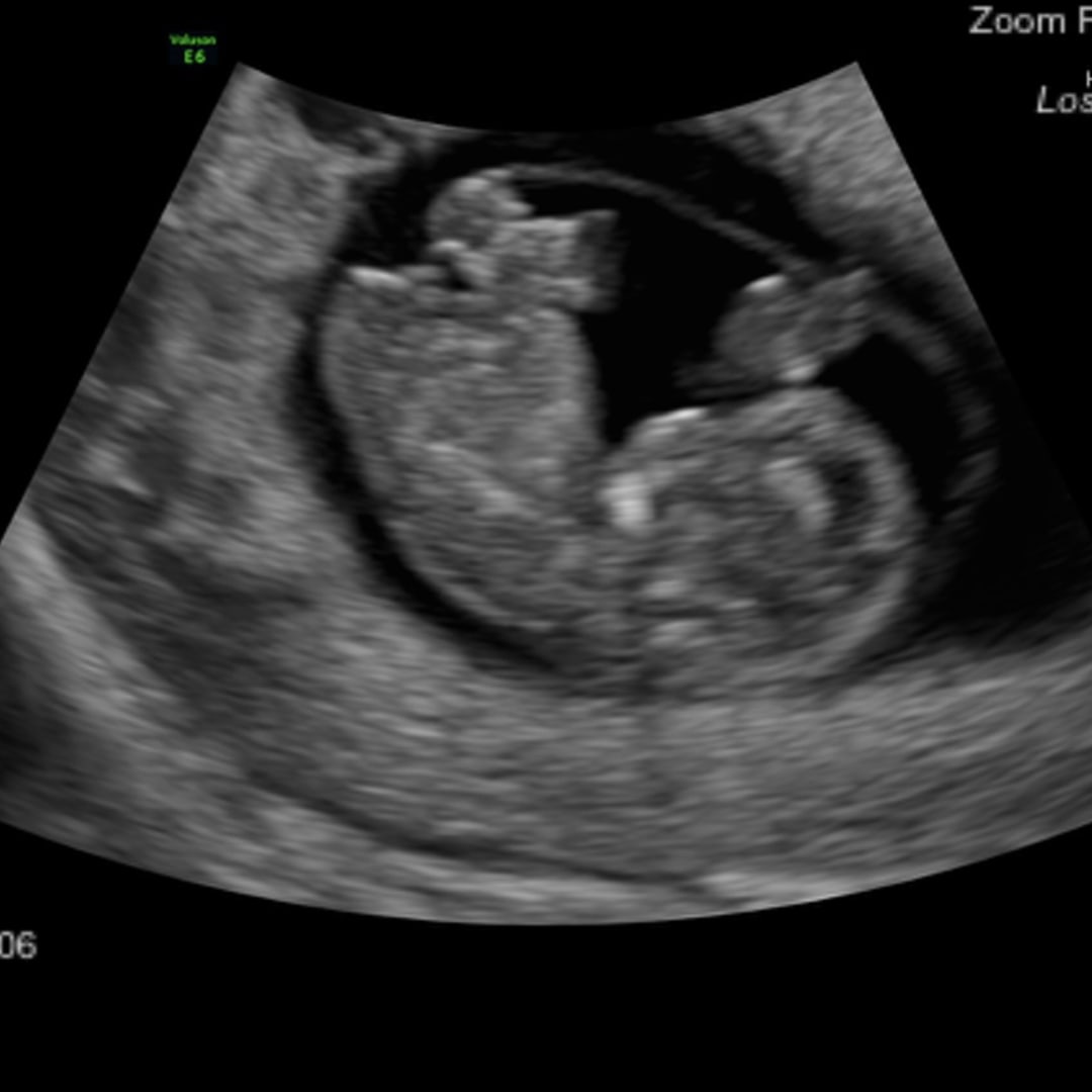 Photo shared by Katherine for their Babylist baby registry.