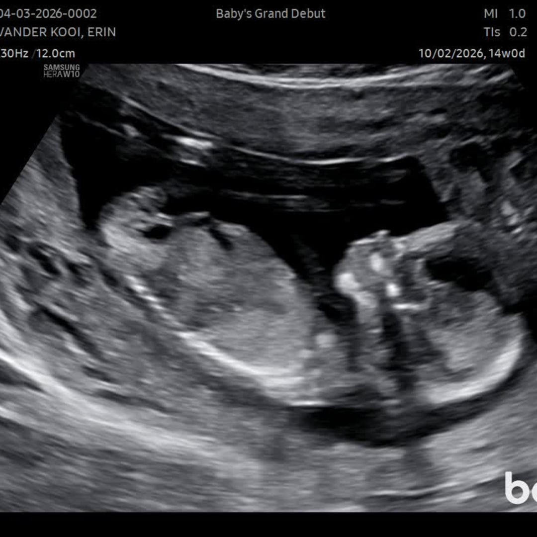 Photo shared by Erin for their Babylist baby registry.