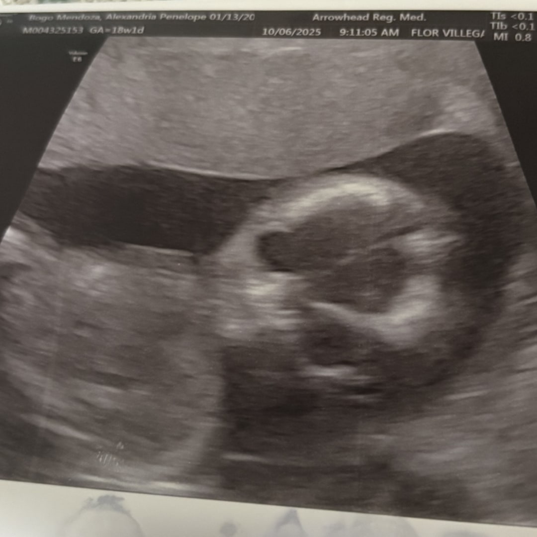 Photo shared by Alexandria for their Babylist baby registry.