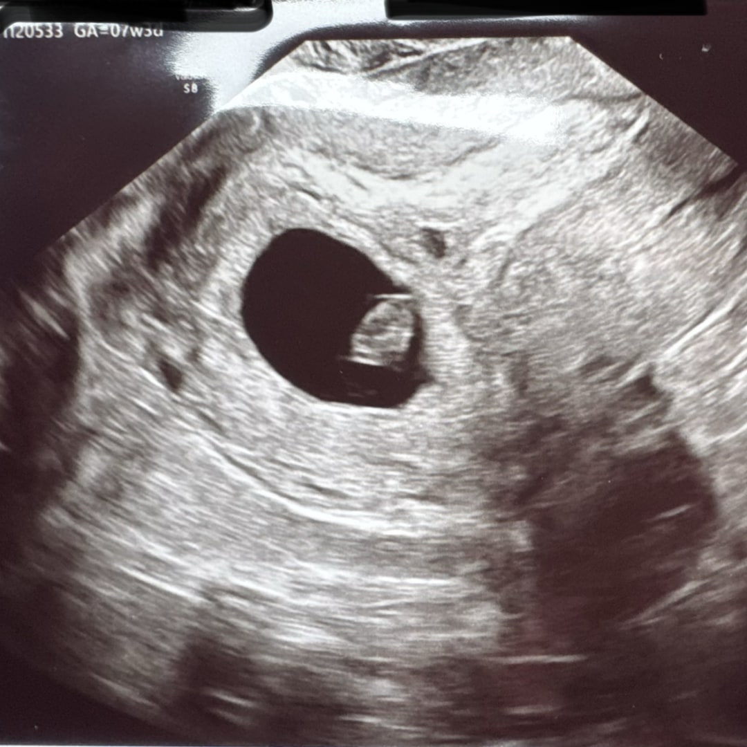 Photo shared by Karina for their Babylist baby registry.