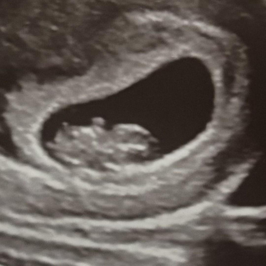 Photo shared by Lauren for their Babylist baby registry.