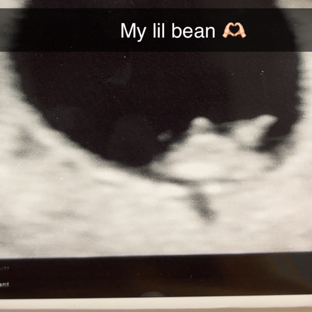 Photo shared by Dixie for their Babylist baby registry.